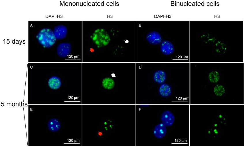 Immunofluorescence with anti-histone H3S10P antibody